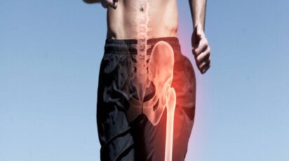 Bursite Trocantérica: Como Aliviar a Dor na Lateral do Quadril ao Deitar (Sem Cirurgia) 3 bursite trocanterica sem cirurgia