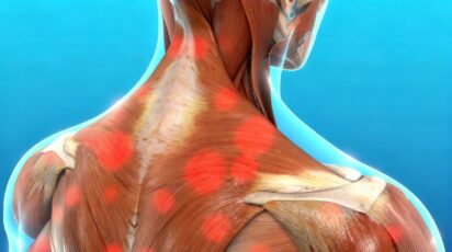 dor miofascial cronica tem cura