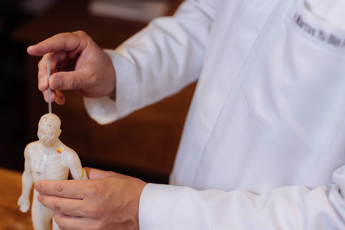 Mãos do médico posicionando uma agulha na cabeça de um boneco de acupuntura