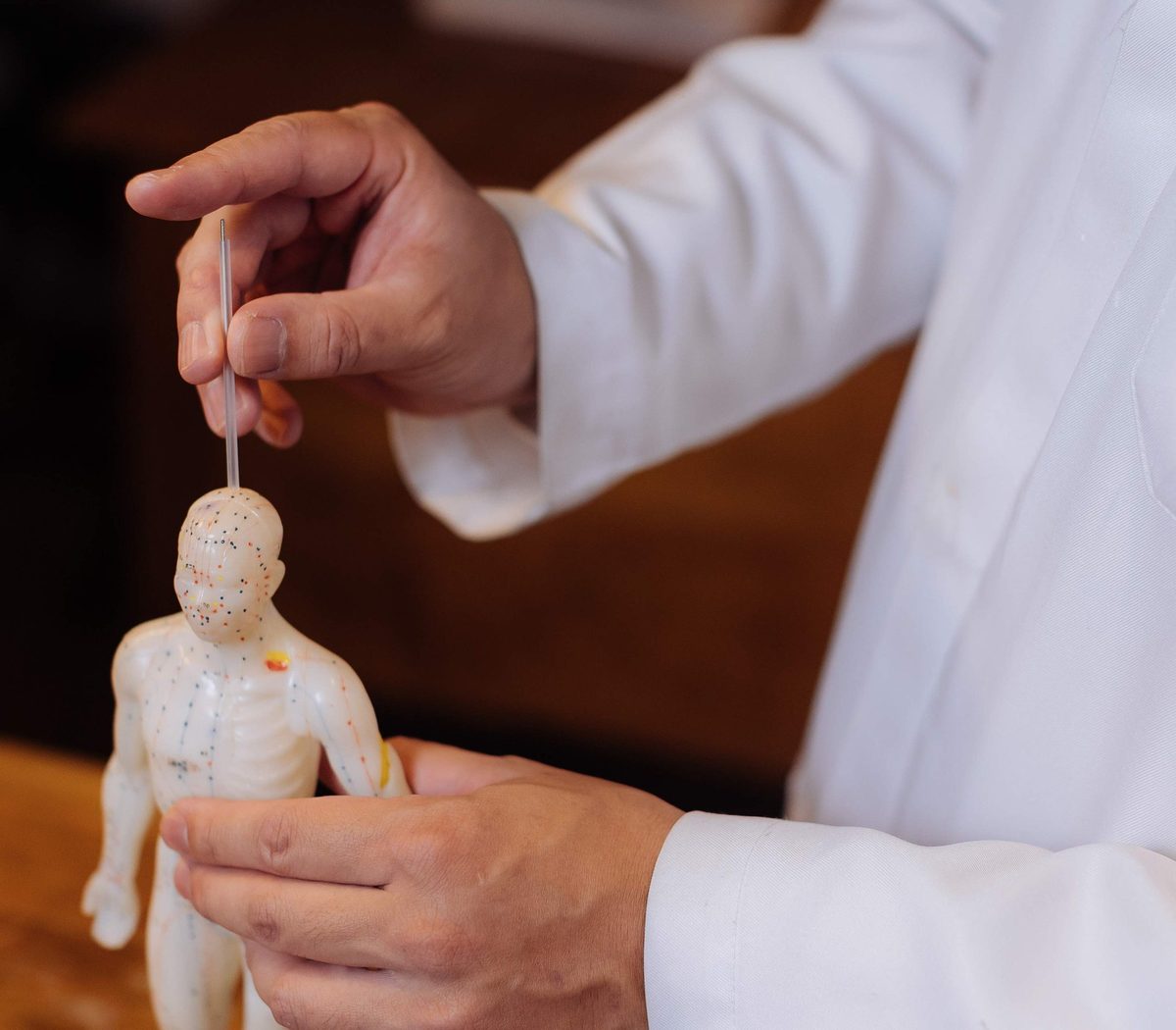 Mãos do médico seguram um boneco de acupuntura e posicionam uma agulha no topo da cabeça