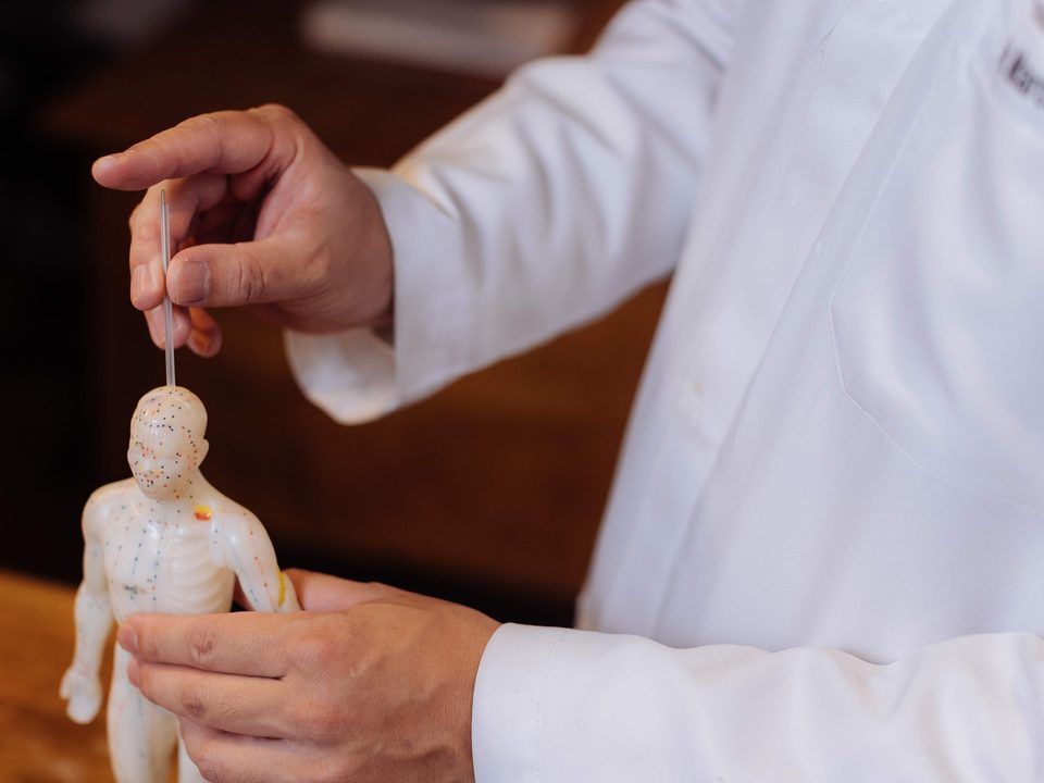 Mãos do médico posicionando uma agulha em um boneco de acupuntura