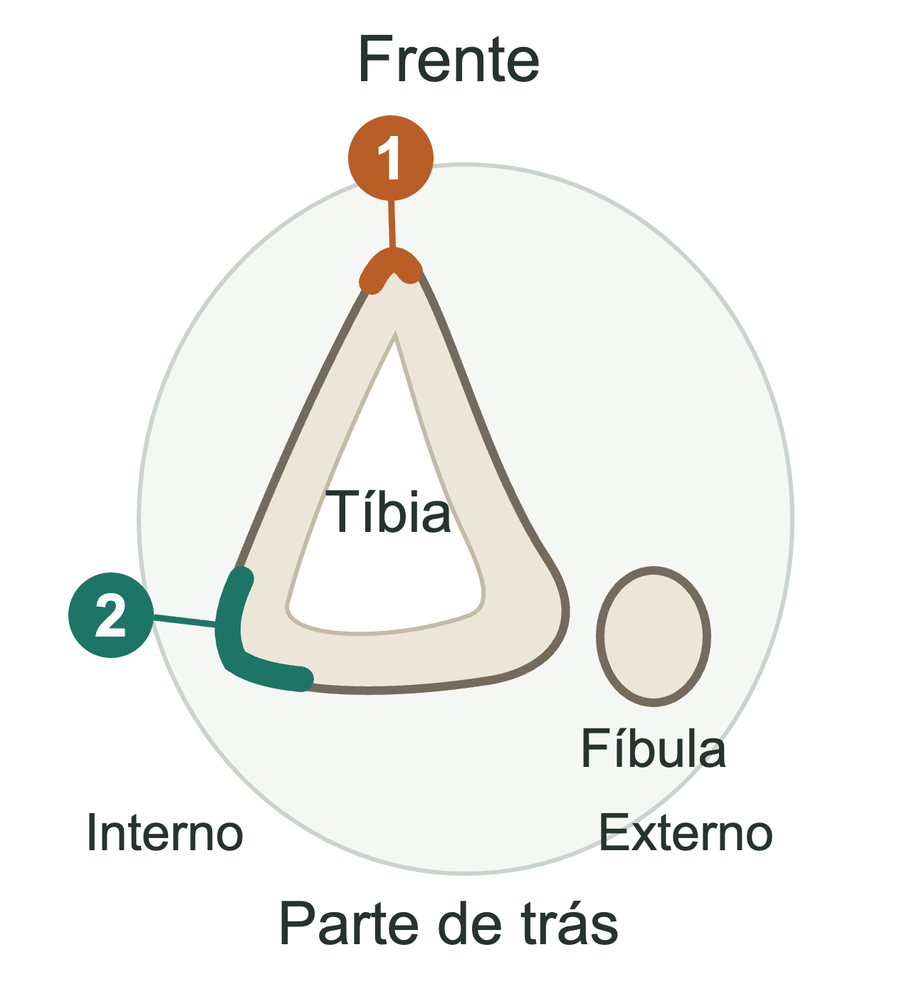 Corte esquemático da perna direita: cortical anterior da tíbia marcada com 1 e região posteromedial com 2; a fíbula fica ao lado externo.