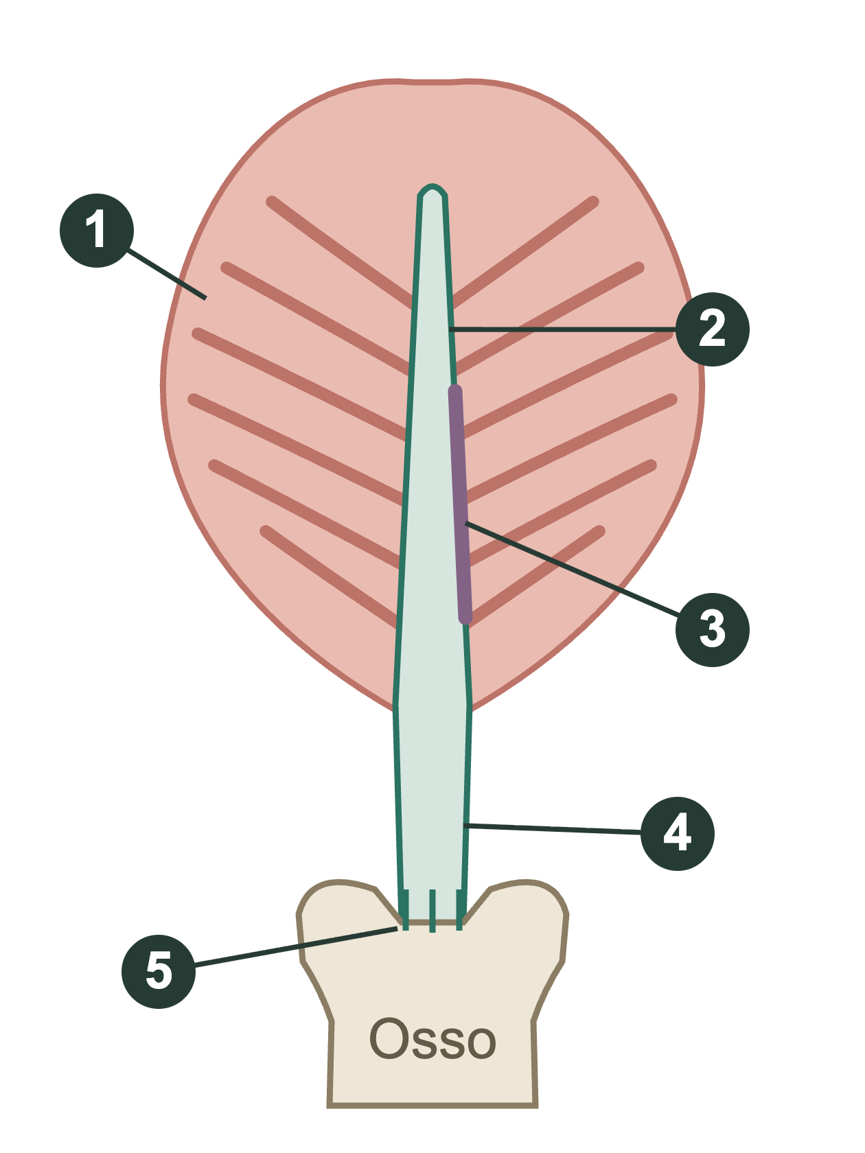 Corte esquemático de uma unidade muscular: feixes dos dois lados se conectam à lâmina aponeurótica central, que continua como tendão livre até a inserção no osso. A interface com as fibras aparece destacada ao longo da lâmina.