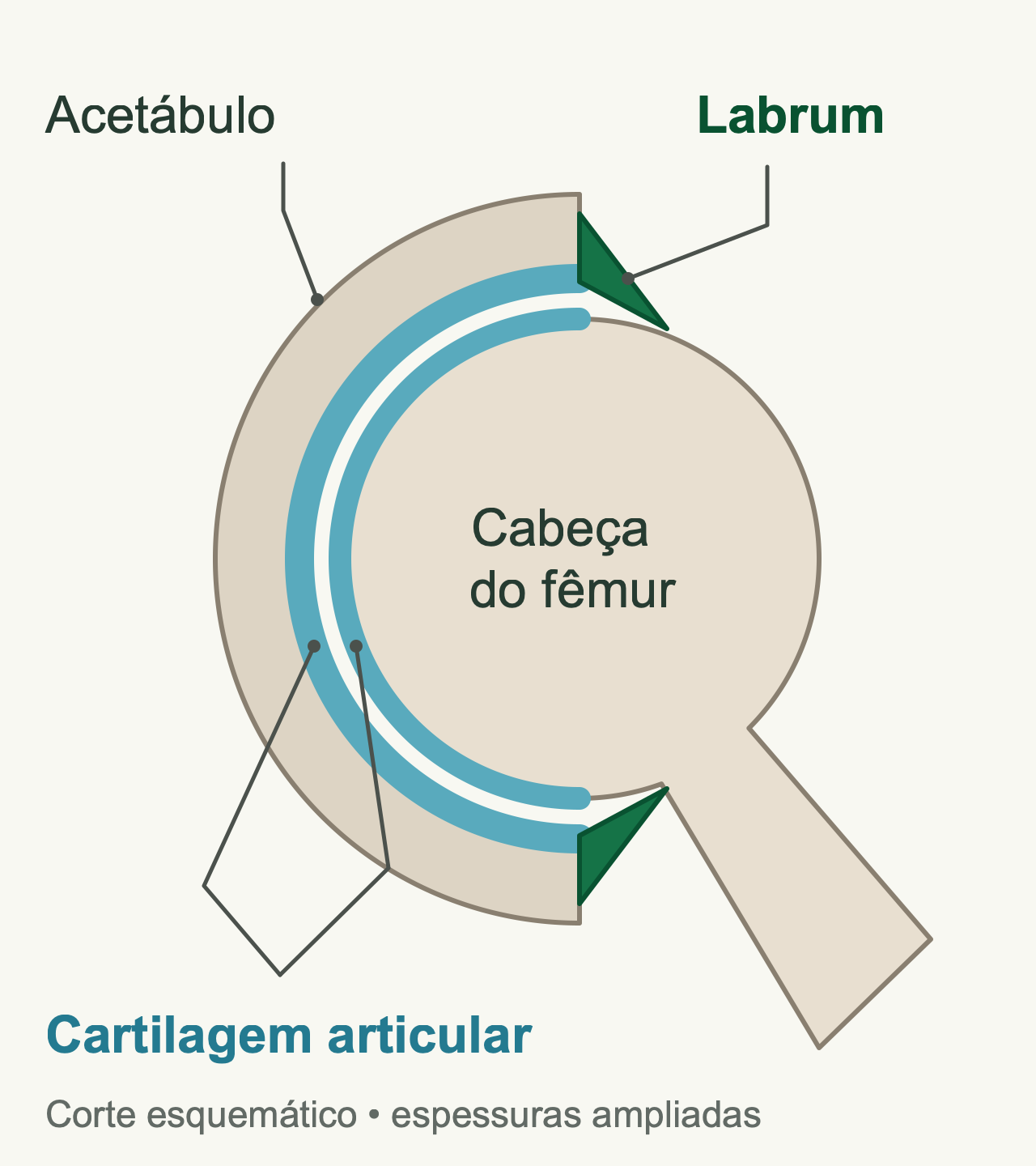 Corte do encaixe do quadril: o labrum verde prolonga a borda óssea do acetábulo; faixas azuis representam a cartilagem articular nas superfícies do acetábulo e da cabeça femoral.